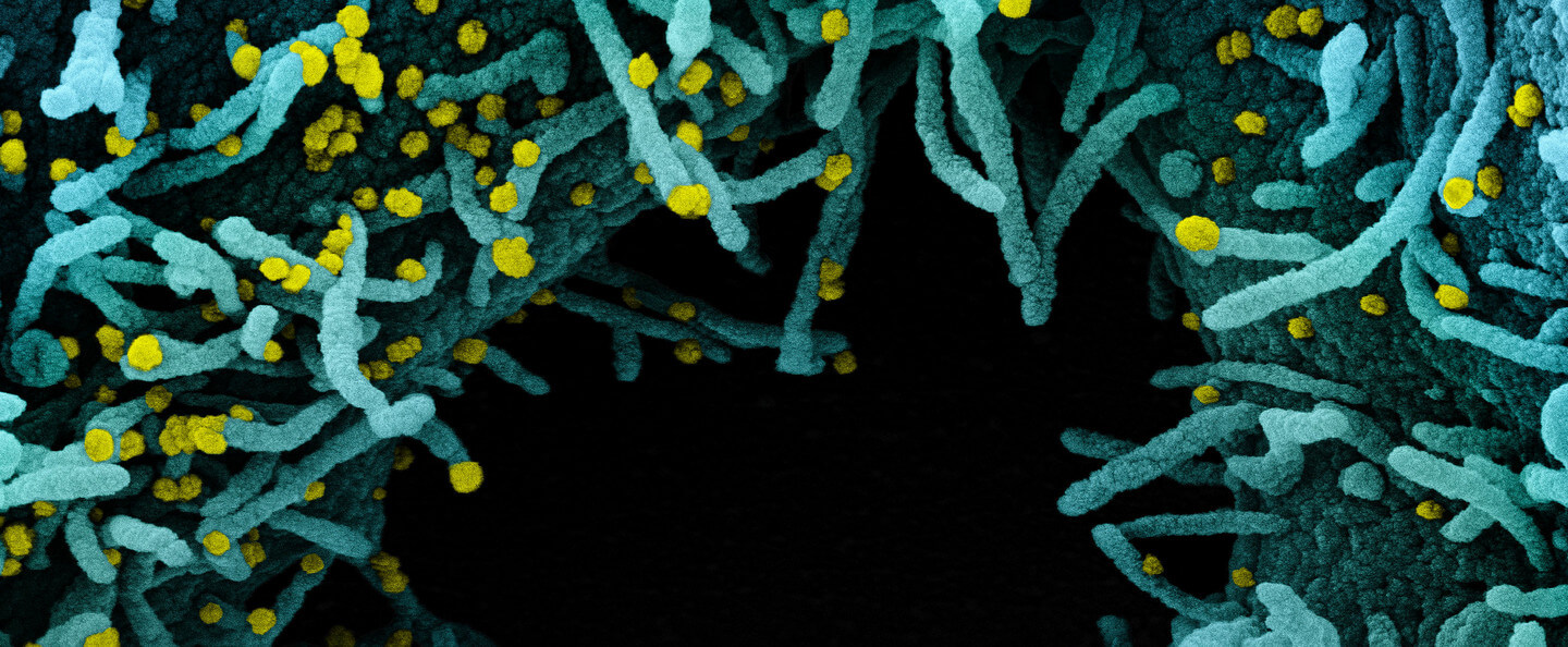 Sars-Cov-2 virus microscope image